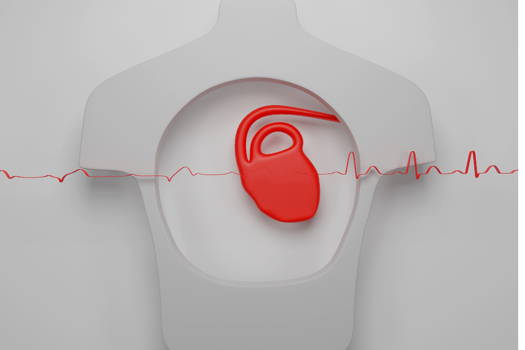 65eabc50ebf28.png 未命名__2024-03-08+14_42_07.png